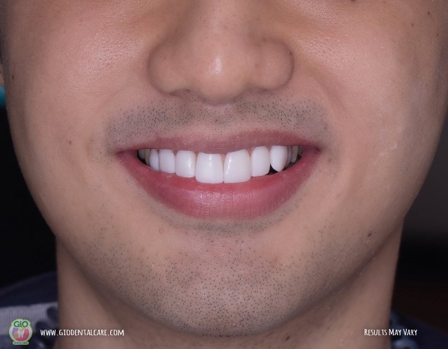 get-your-smile-here-